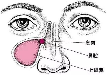 鼻部解剖图及引发并发症