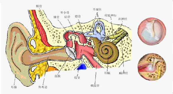 耳部结构解析图——耳聋